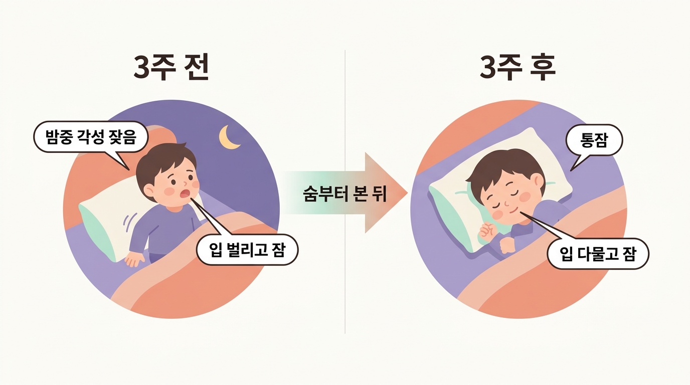 숨을 먼저 살핀 뒤 3주간 밤중 각성과 입벌림이 줄어든 서준이의 변화를 전후로 비교한 사례 인포그래픽