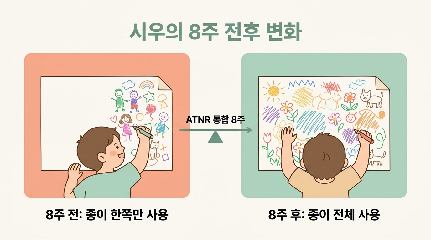 ATNR 통합 8주 전후 변화 비교 한쪽으로 치우친 그림과 양손 사용 가능한 균형 잡힌 그림 일러스트 분할 한글 라벨 비교 인포그래픽